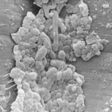 Förstoring av ett defekt områden som visar föroreningar och olika typer av mikroorganismer i ett bronkoskop för flergångsbruk