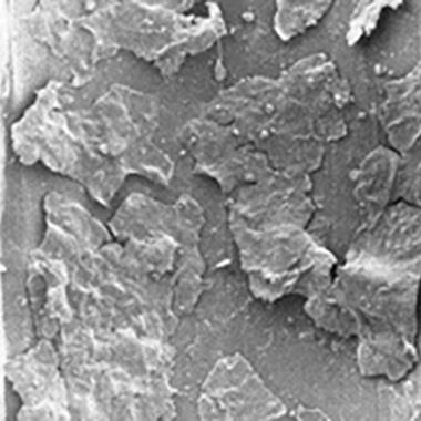 Förstorad bild som visar lager med föroreningar och biofilm i ett återanvändbart bronkoskops luft-/vattenkanaler