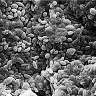 Flerskiktad biofilm med celler som ser friska ut omgivna och täckta av extracellulära polysackarider med ett amorft utseende i ett återanvändbart bronkoskops luft-/vattenkanaler