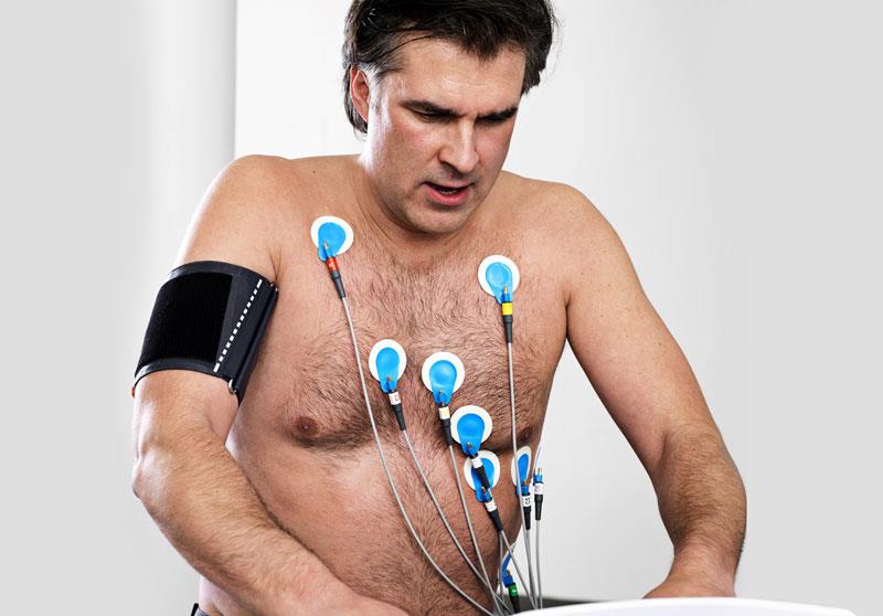 Patient utför ett arbetsprov på cykel med BlueSensor EKG-elektroder på sig