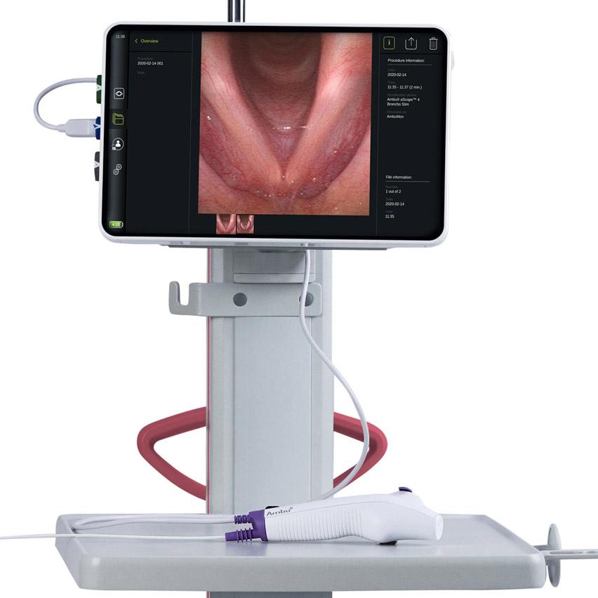 The Ambu® aScope™ 4 Broncho Regular 5.0/2.2 single-use bronchoscope